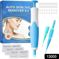 Urban Skin Tag Remover Kit 2 in 1 for Micro to Large (2 mm - 8 mm) - Mr Urban Choices